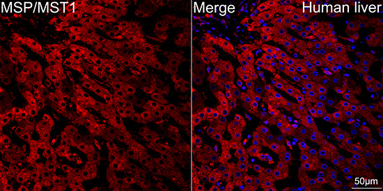 MSP/MST1 Rabbit mAb
