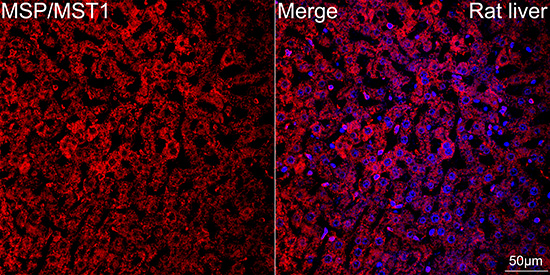 MSP/MST1 Rabbit mAb