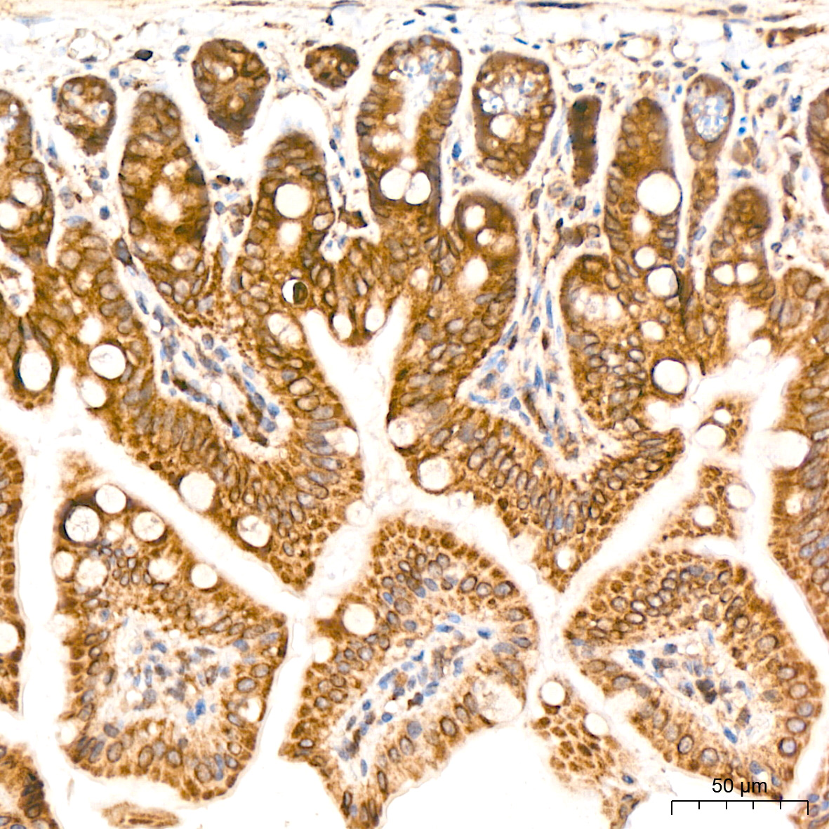 MSP/MST1 Rabbit mAb