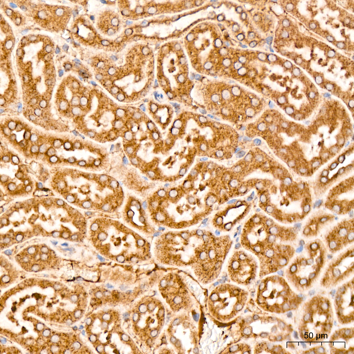 MSP/MST1 Rabbit mAb