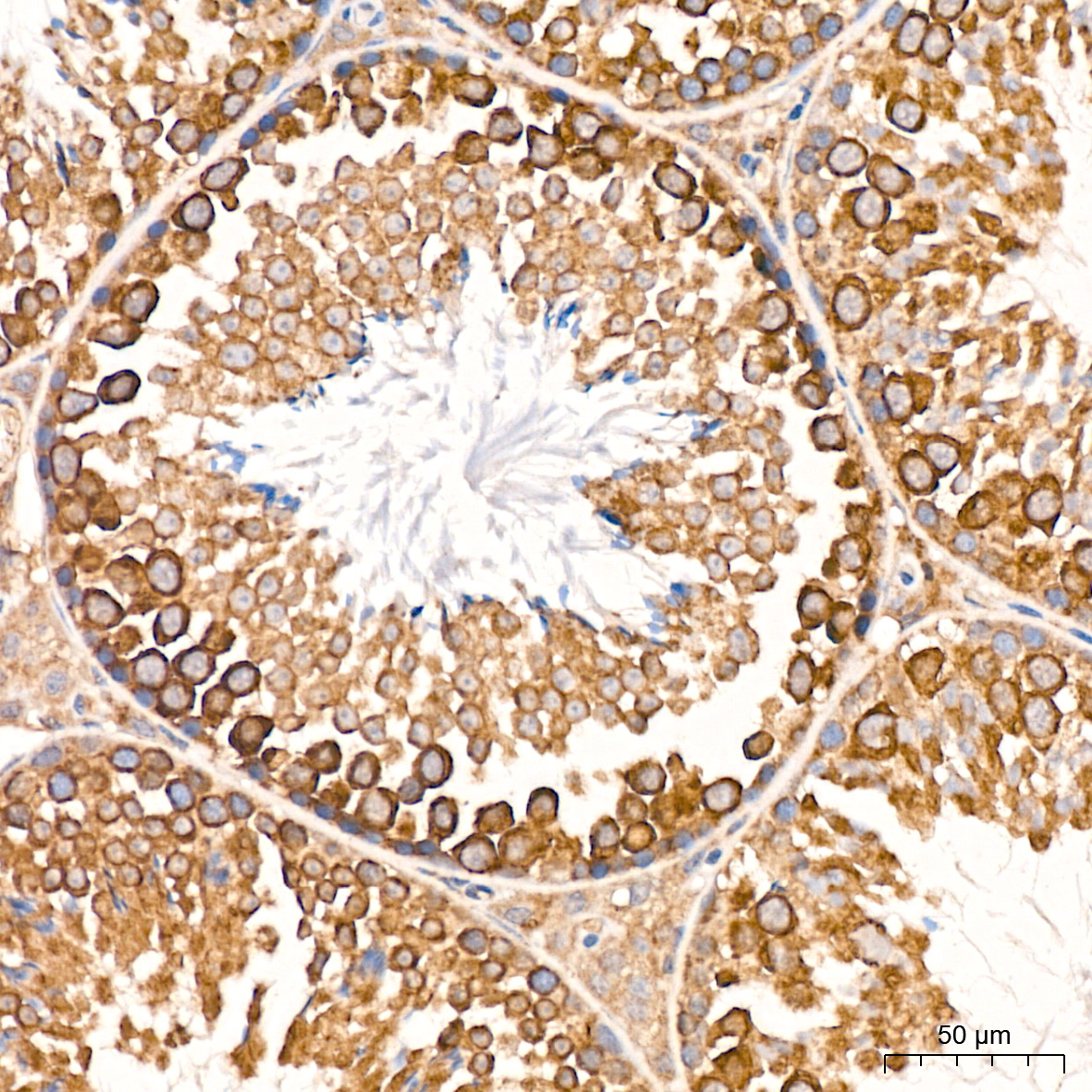 MSP/MST1 Rabbit mAb