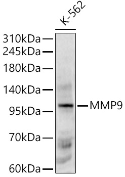 MMP9 Rabbit pAb