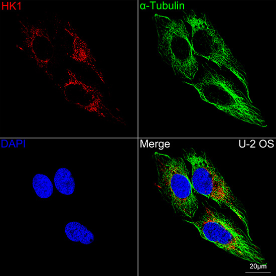 [KO Validated] HK1 Rabbit mAb