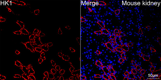 [KO Validated] HK1 Rabbit mAb