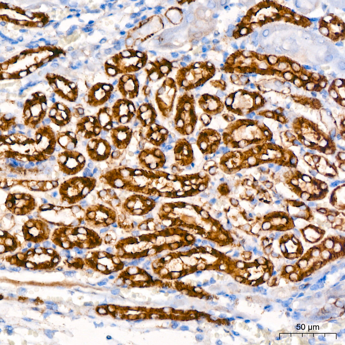 [KO Validated] HK1 Rabbit mAb