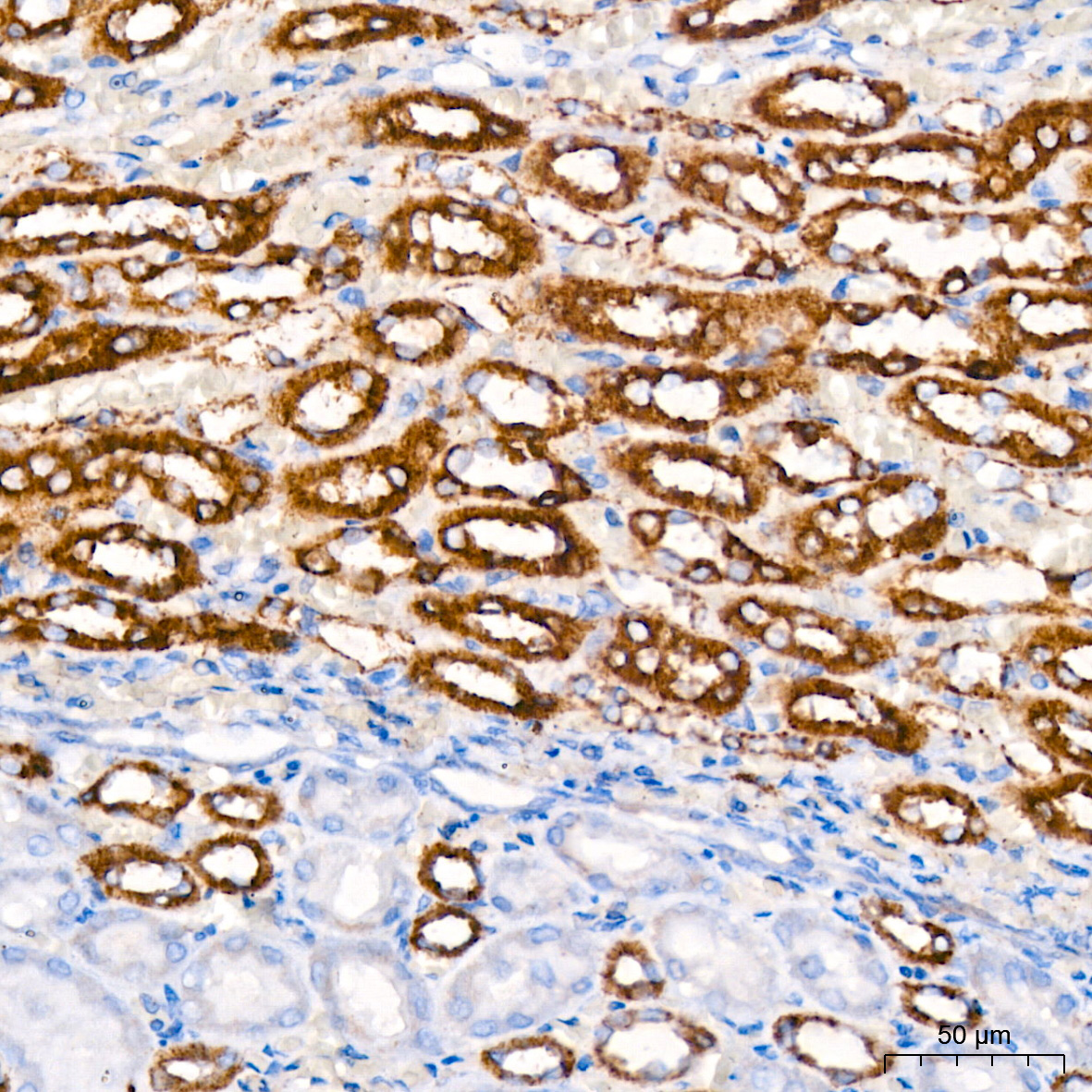 [KO Validated] HK1 Rabbit mAb