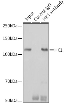 [KO Validated] HK1 Rabbit mAb
