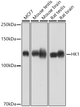 [KO Validated] HK1 Rabbit mAb