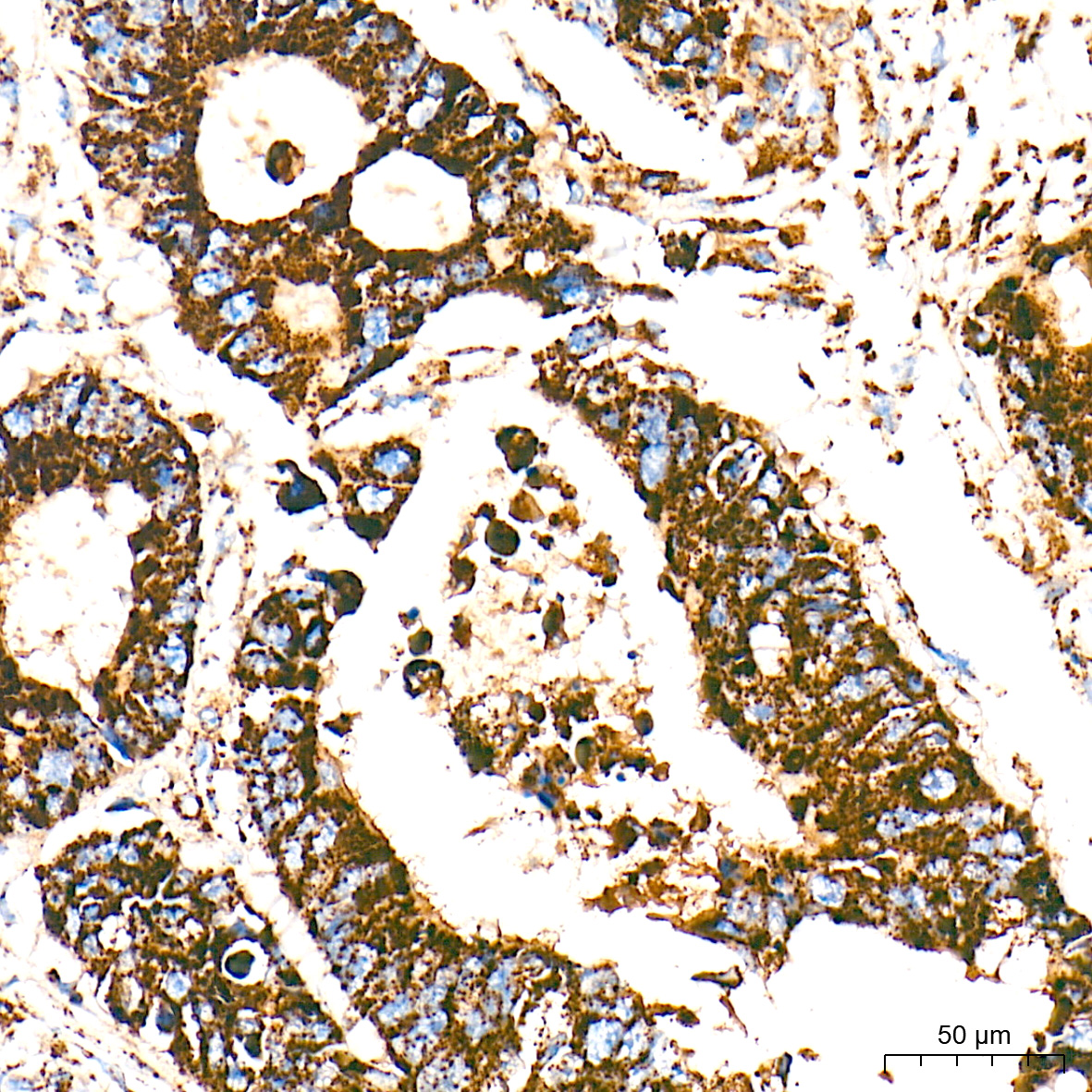 HSP60/HSPD1 Rabbit mAb