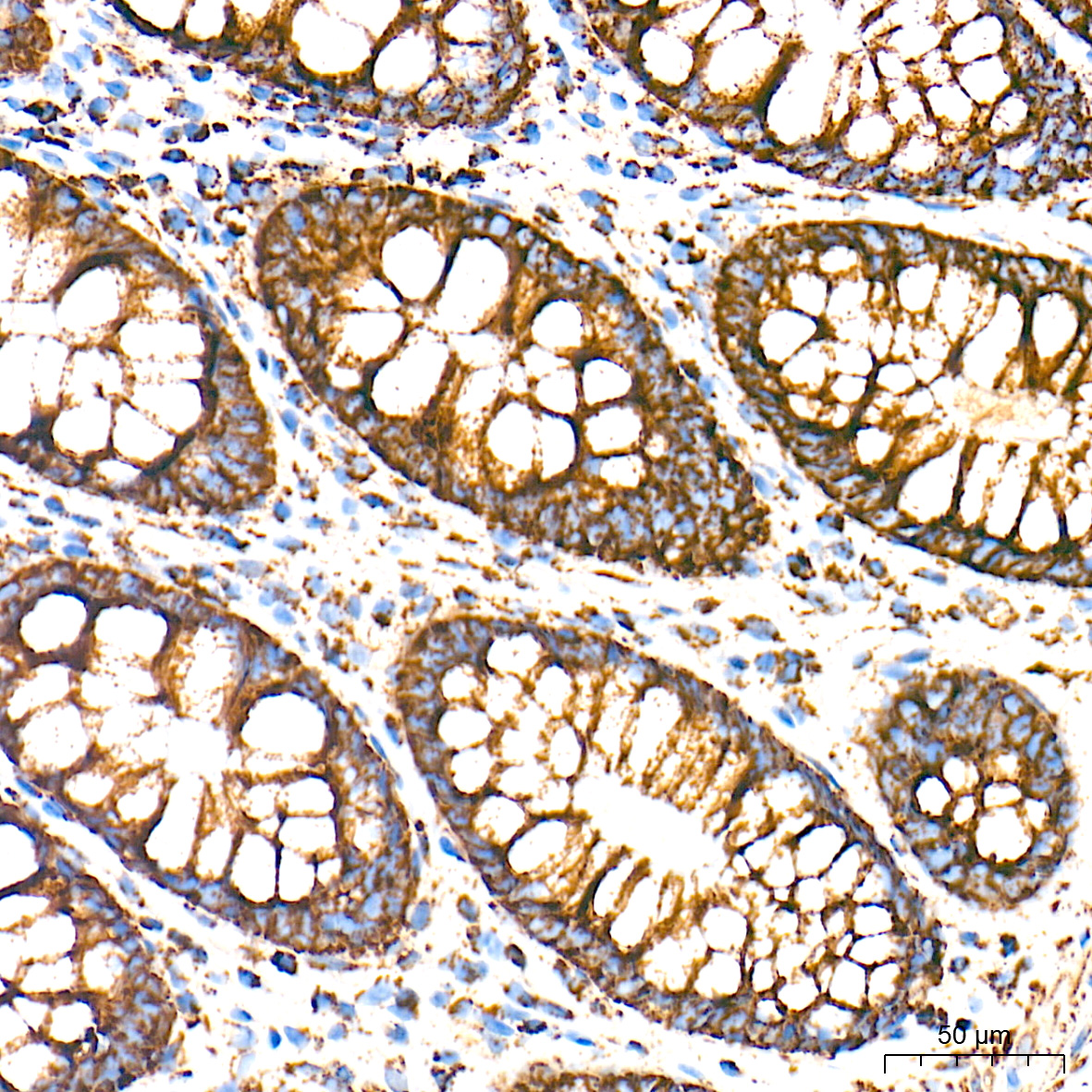 HSP60/HSPD1 Rabbit mAb