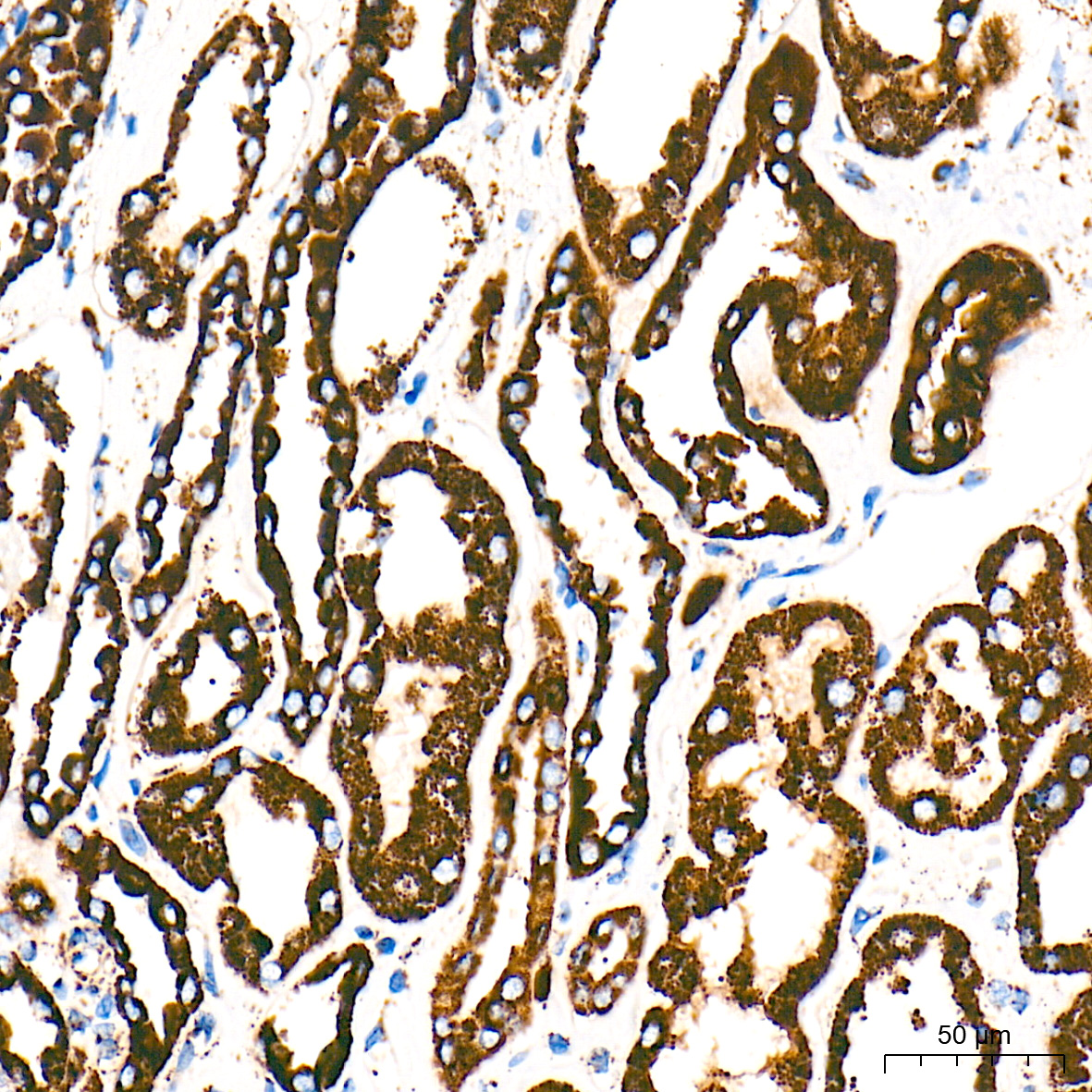 HSP60/HSPD1 Rabbit mAb