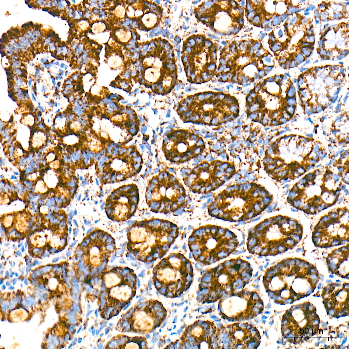 HSP60/HSPD1 Rabbit mAb