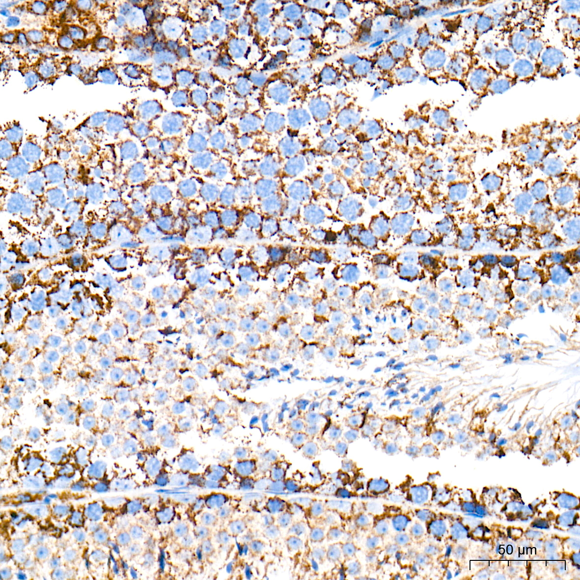 HSP60/HSPD1 Rabbit mAb