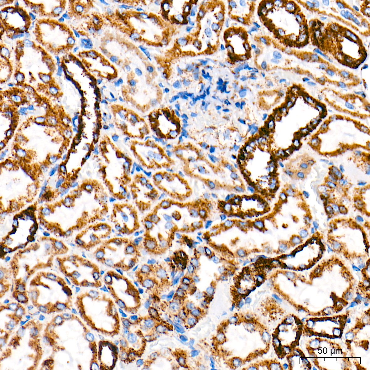 HSP60/HSPD1 Rabbit mAb