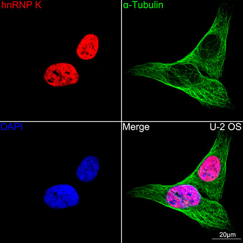 hnRNP K Rabbit mAb