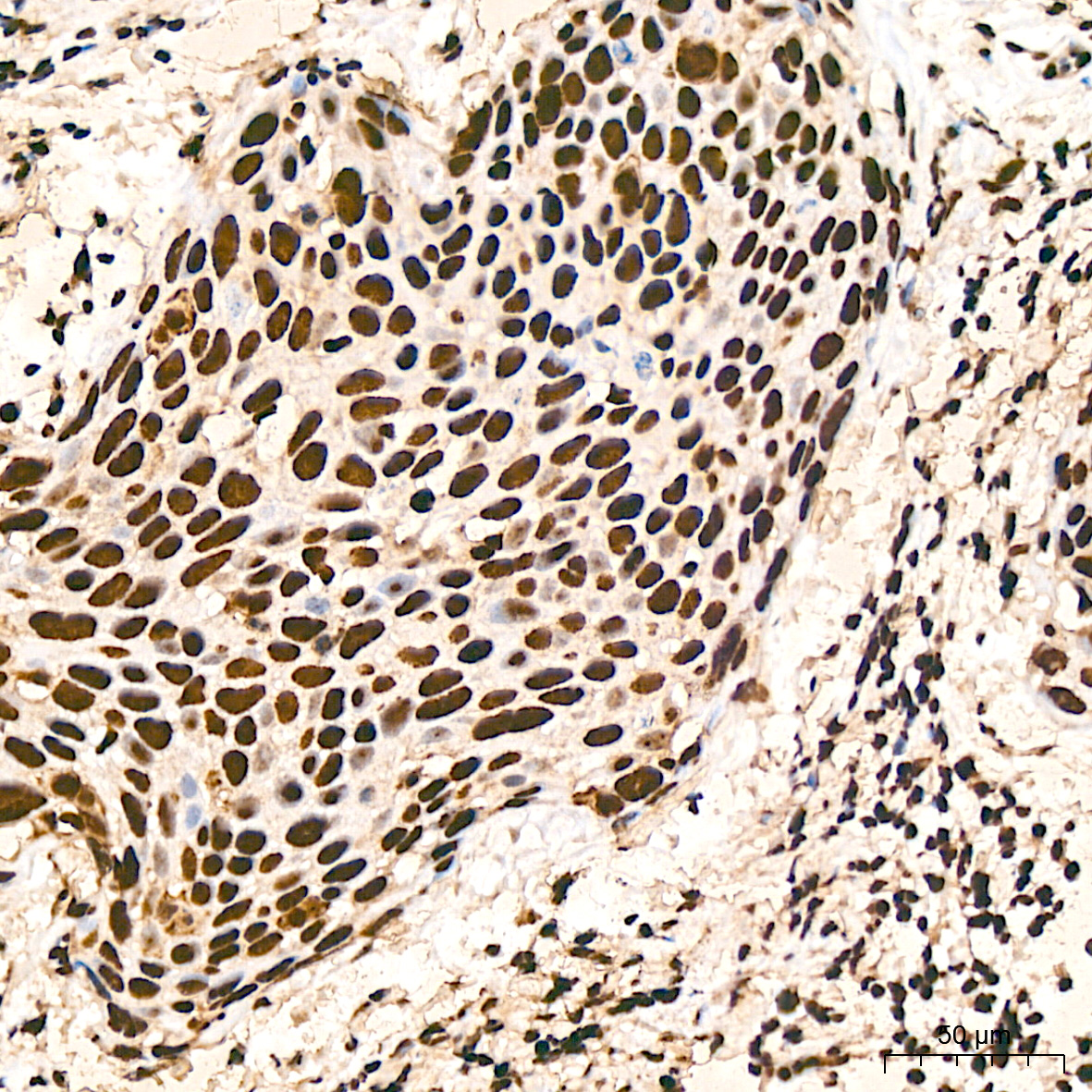 hnRNP K Rabbit mAb