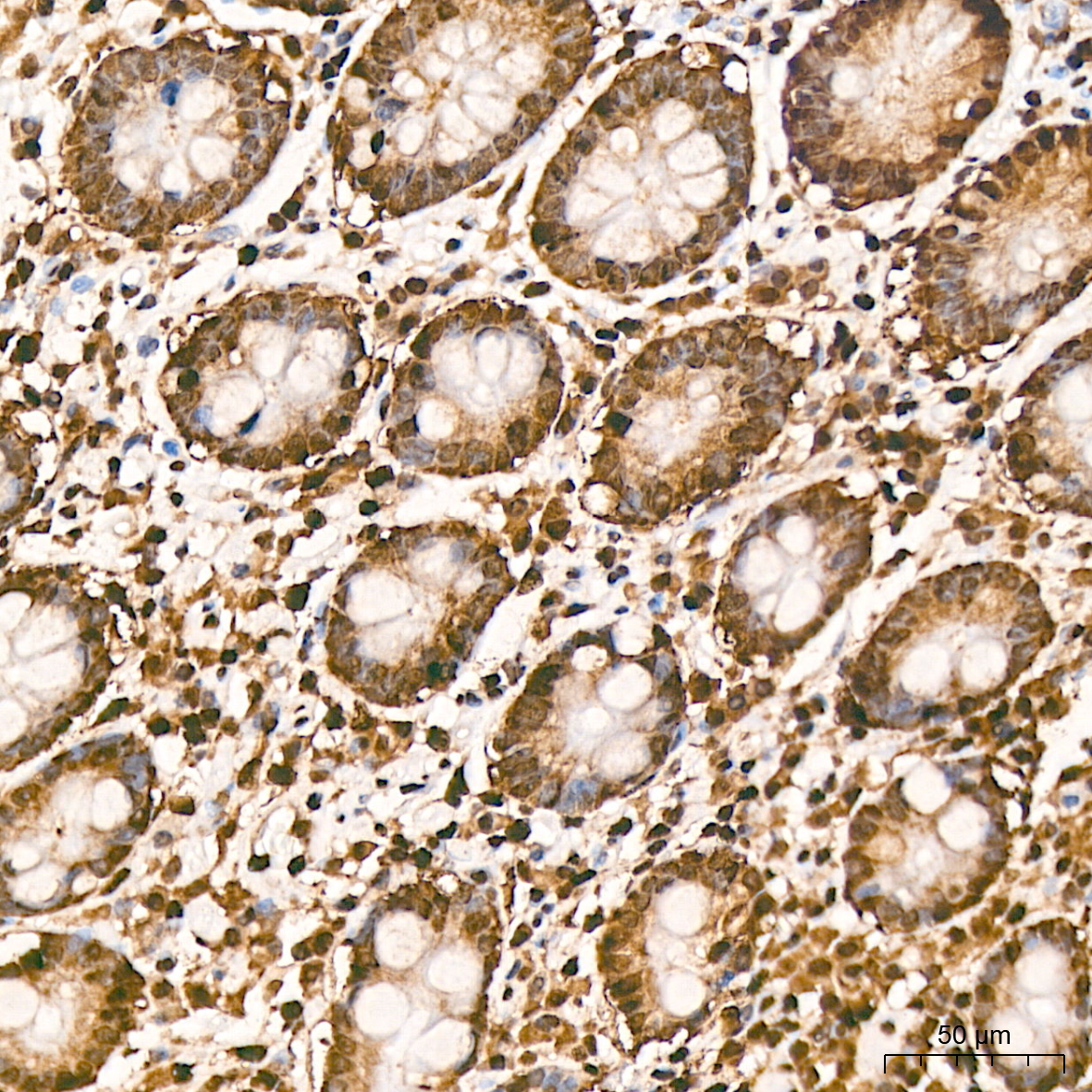 hnRNP K Rabbit mAb