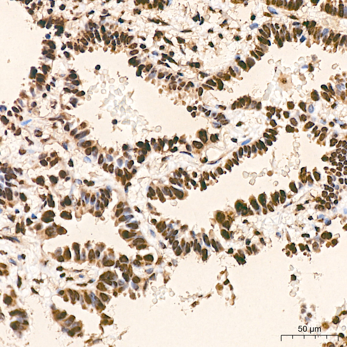 hnRNP K Rabbit mAb