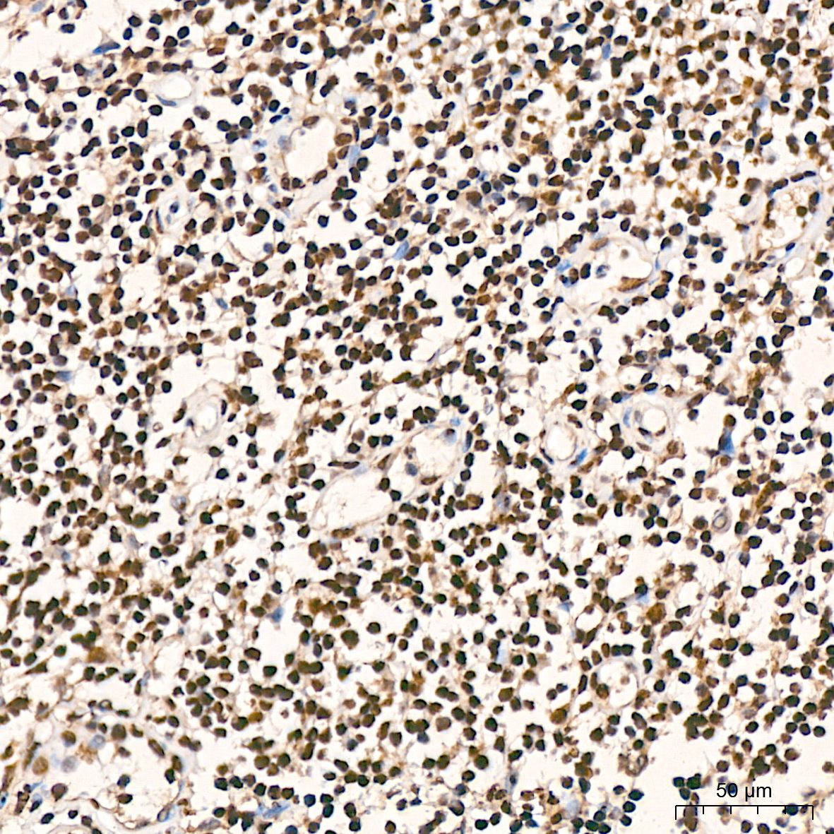 hnRNP K Rabbit mAb