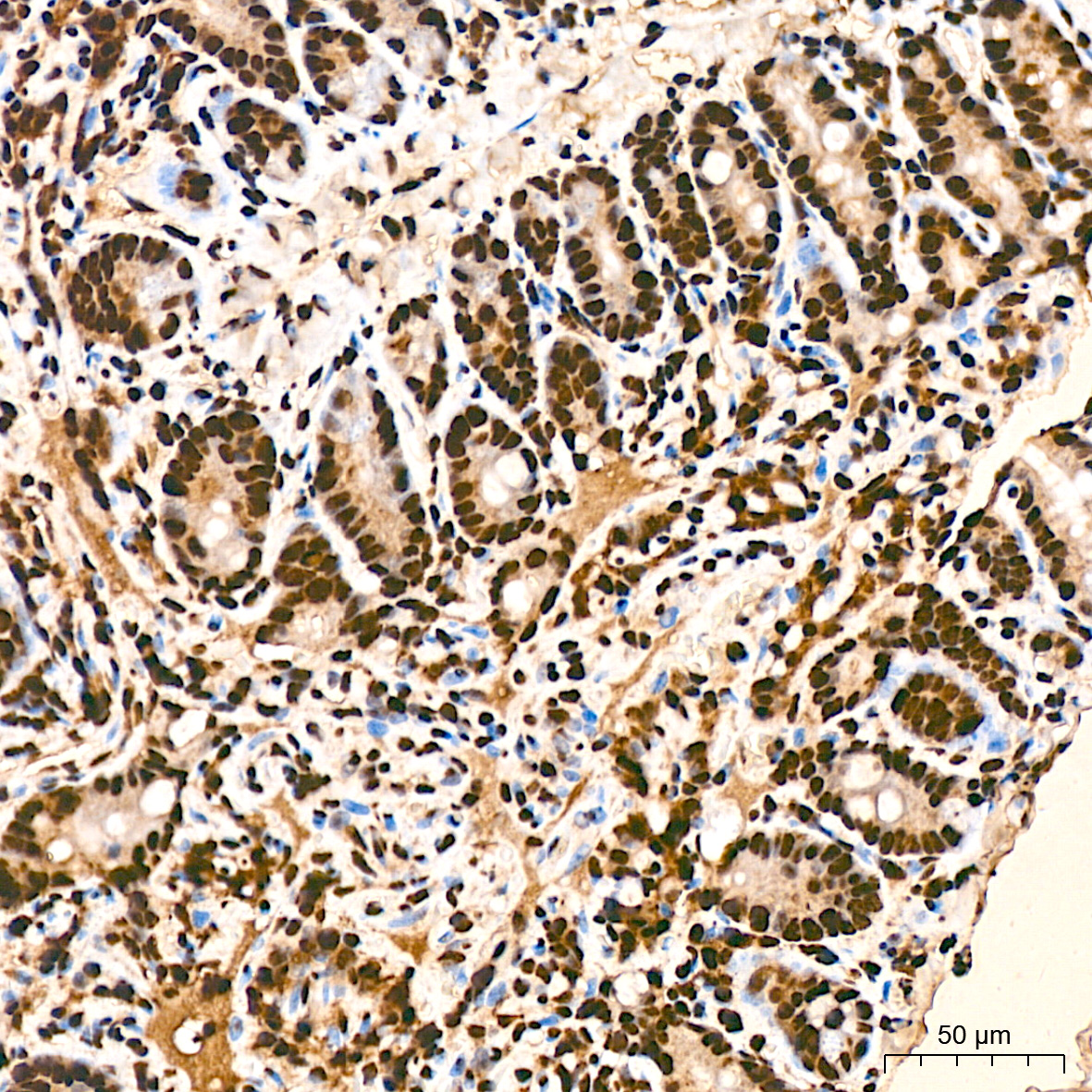 hnRNP K Rabbit mAb