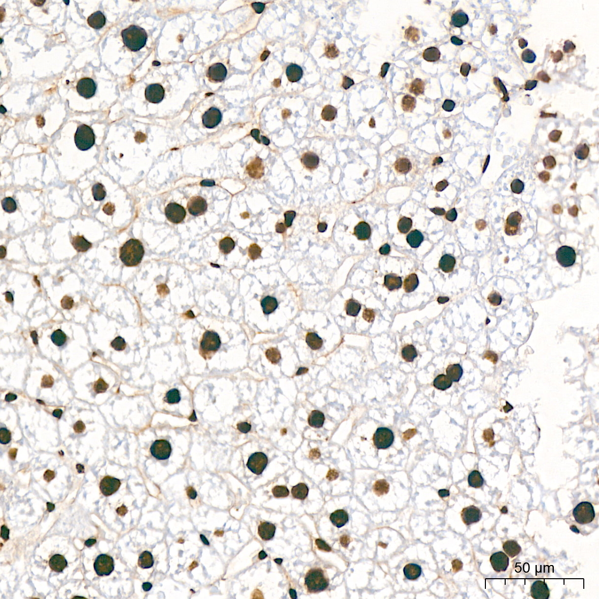 hnRNP K Rabbit mAb