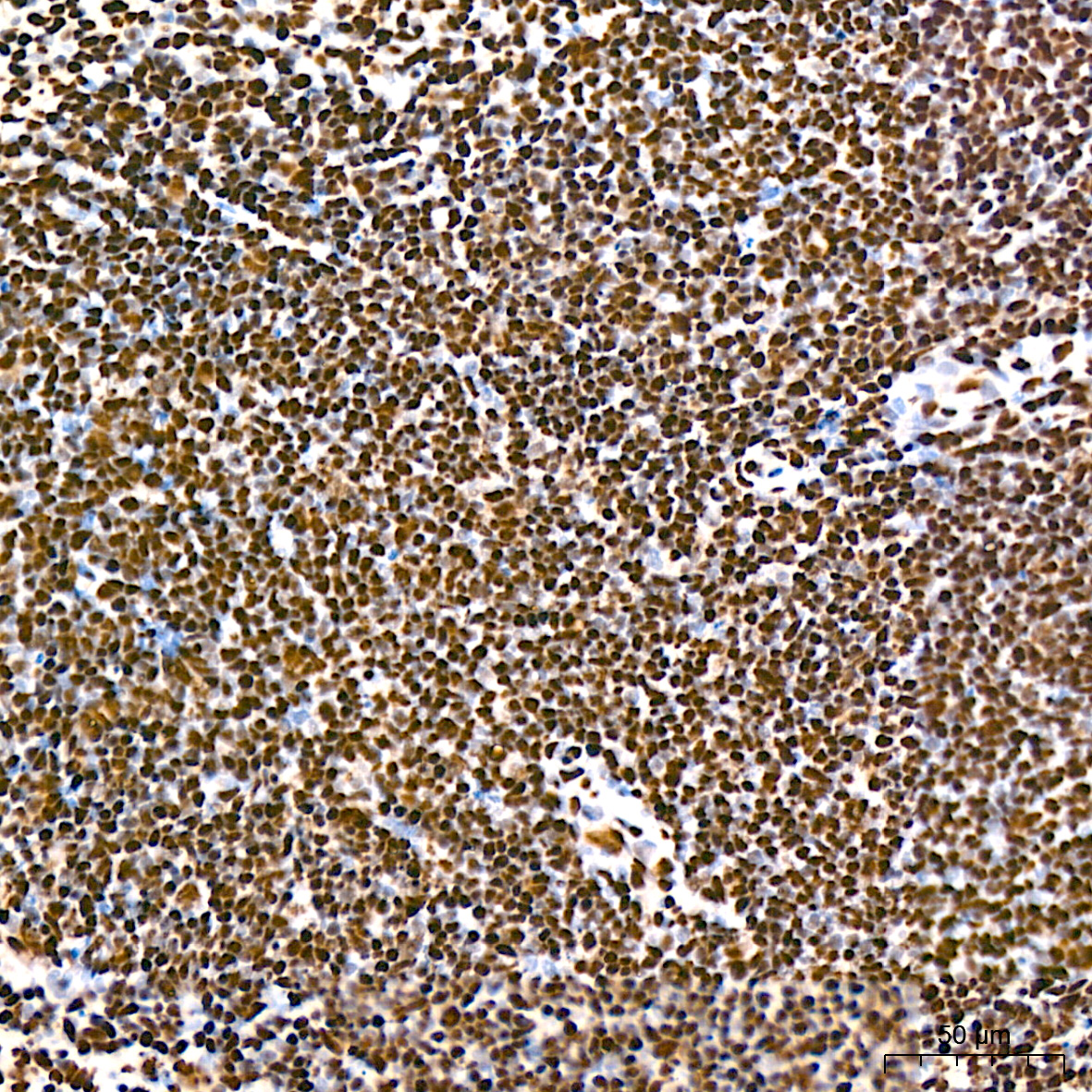 hnRNP K Rabbit mAb
