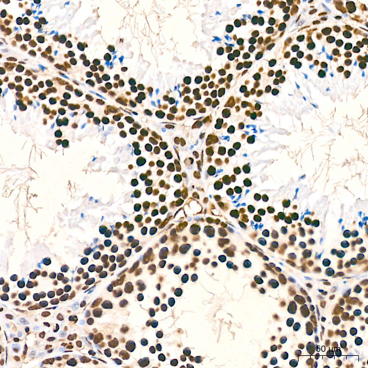 hnRNP K Rabbit mAb