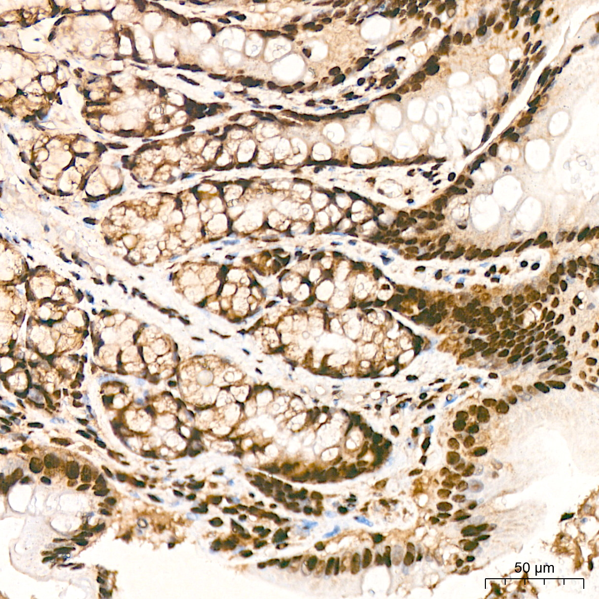 hnRNP K Rabbit mAb