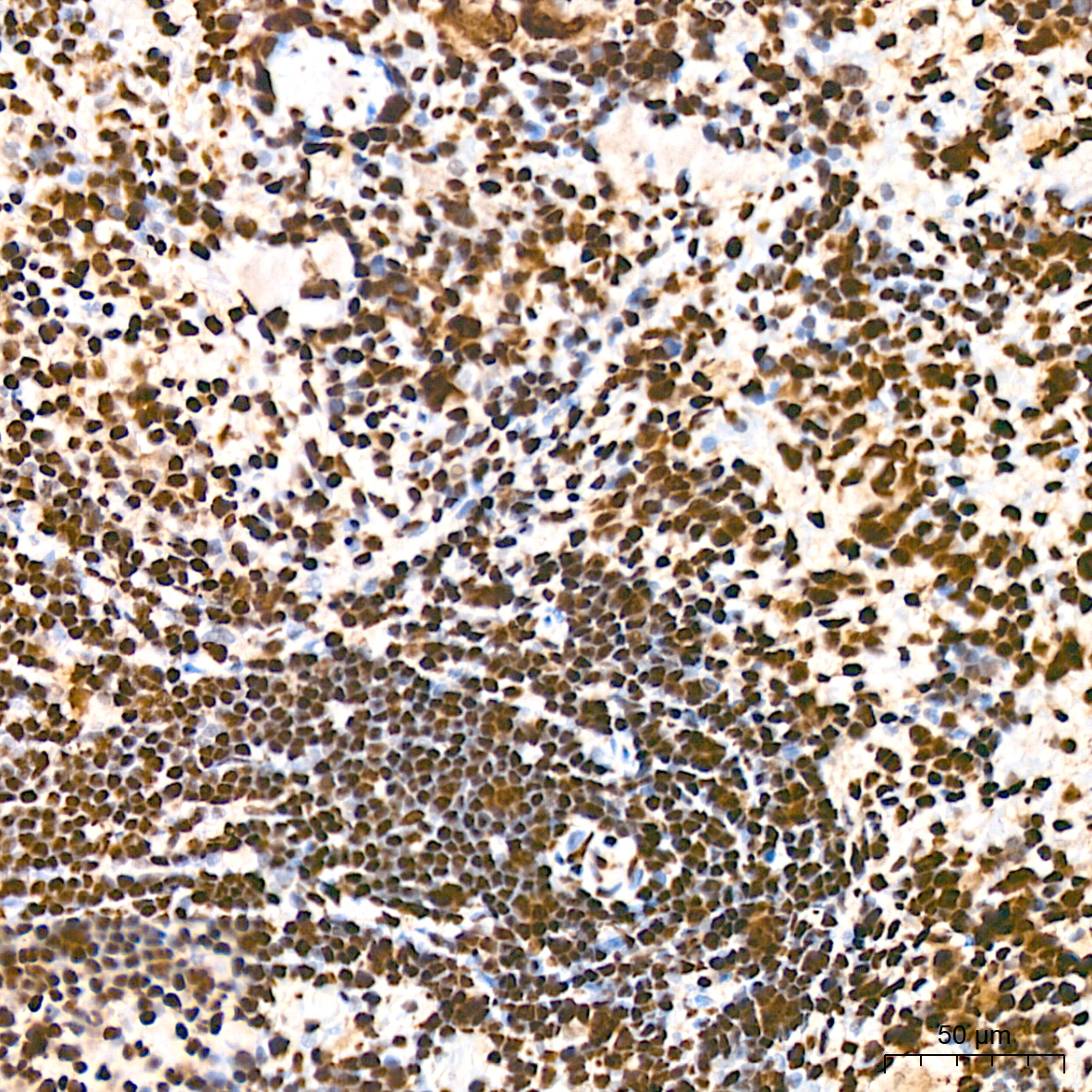hnRNP K Rabbit mAb