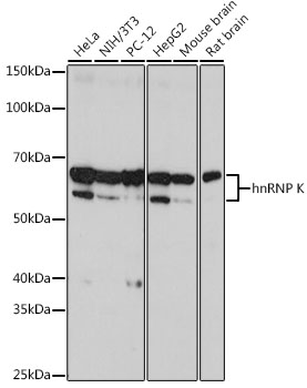 hnRNP K Rabbit mAb