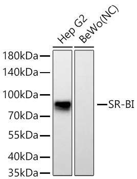 SR-BI Rabbit mAb