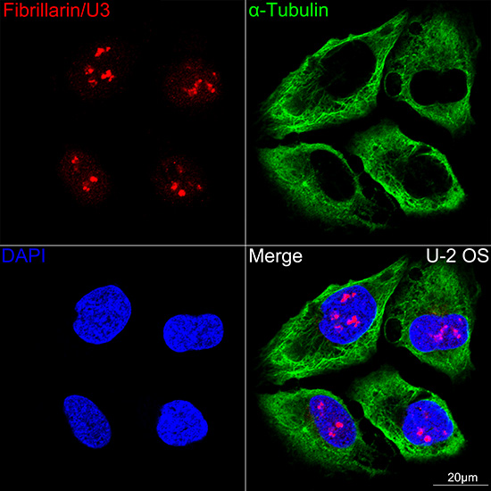 Fibrillarin/U3 RNP Rabbit mAb