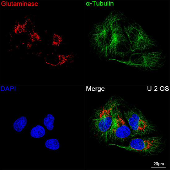 Glutaminase (GLS) Rabbit mAb