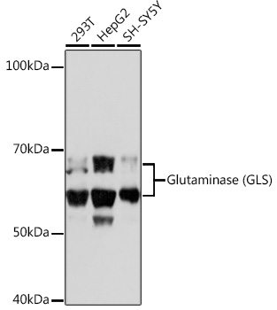 Glutaminase (GLS) Rabbit mAb