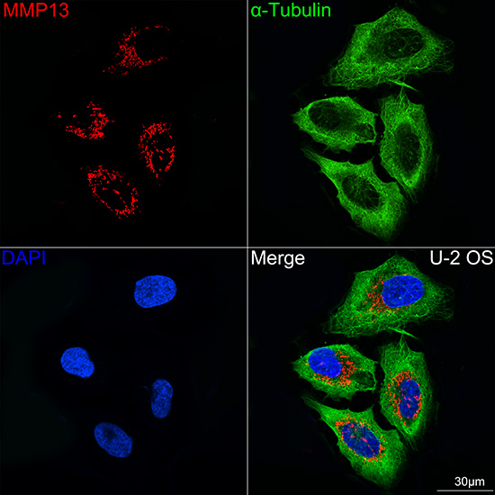 MMP13 Rabbit mAb