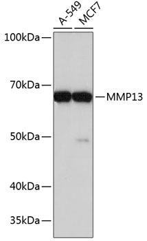 MMP13 Rabbit mAb
