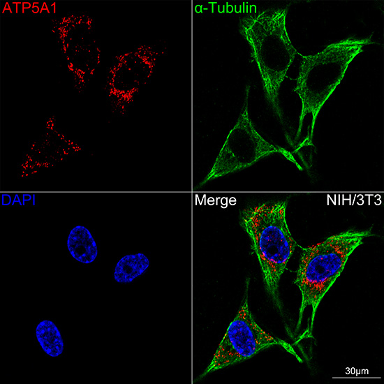 ATP5A1 Rabbit mAb