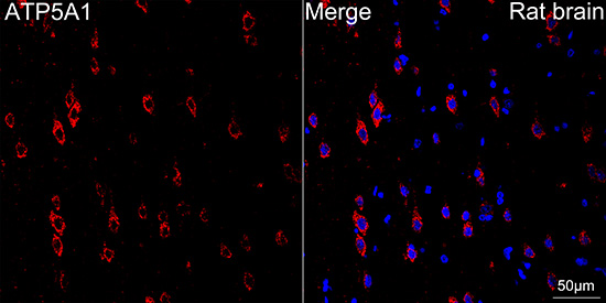 ATP5A1 Rabbit mAb