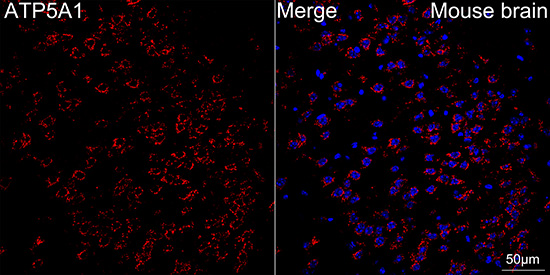 ATP5A1 Rabbit mAb
