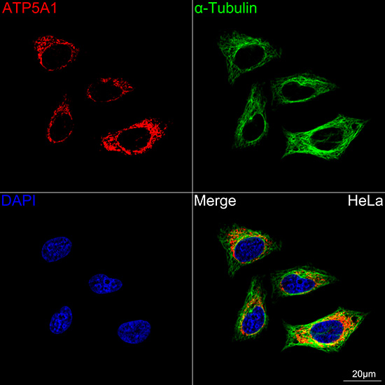 ATP5A1 Rabbit mAb