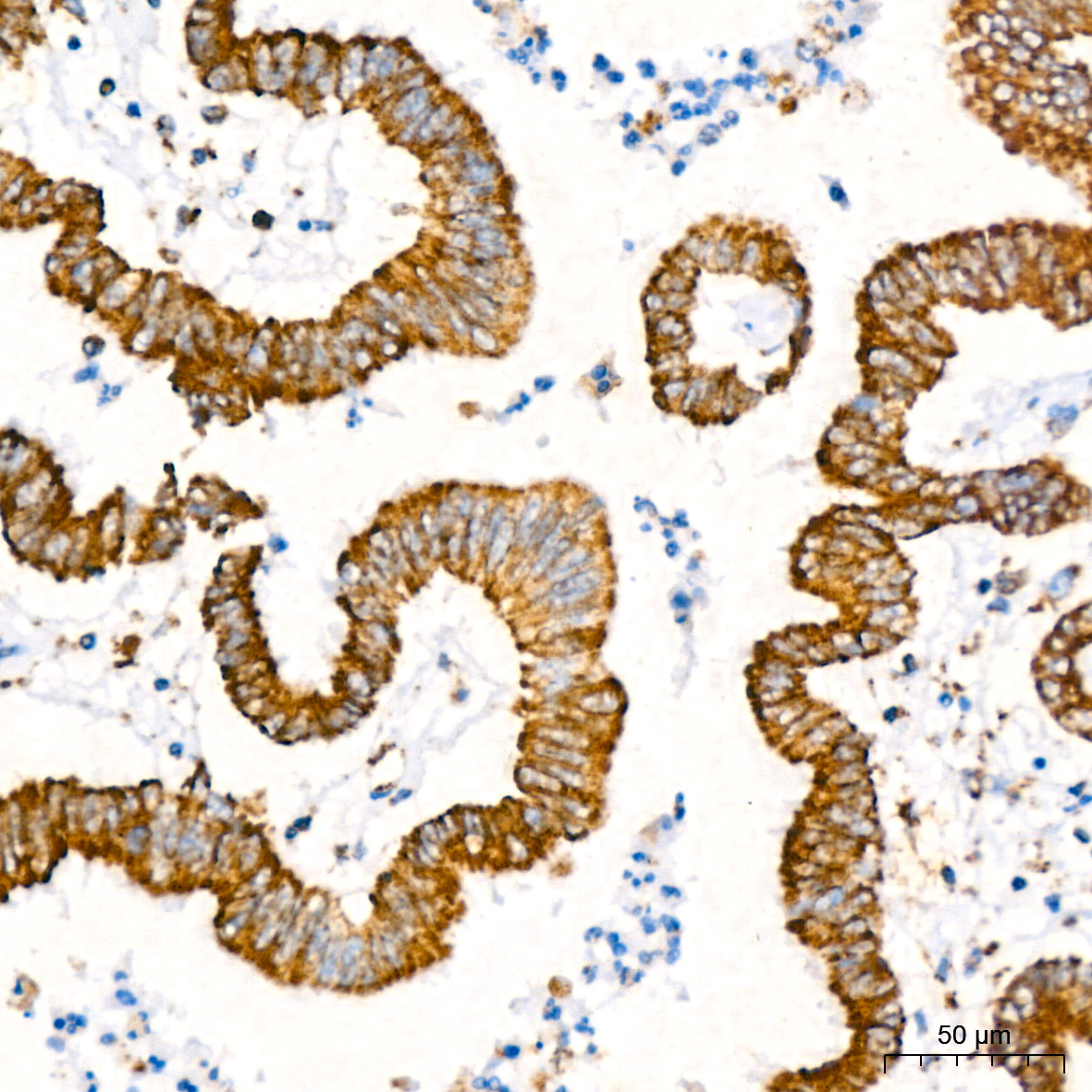 ATP5A1 Rabbit mAb