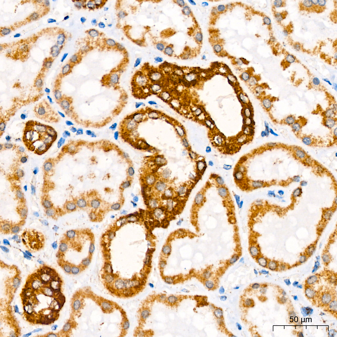 ATP5A1 Rabbit mAb