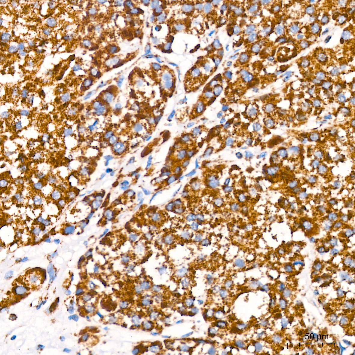ATP5A1 Rabbit mAb