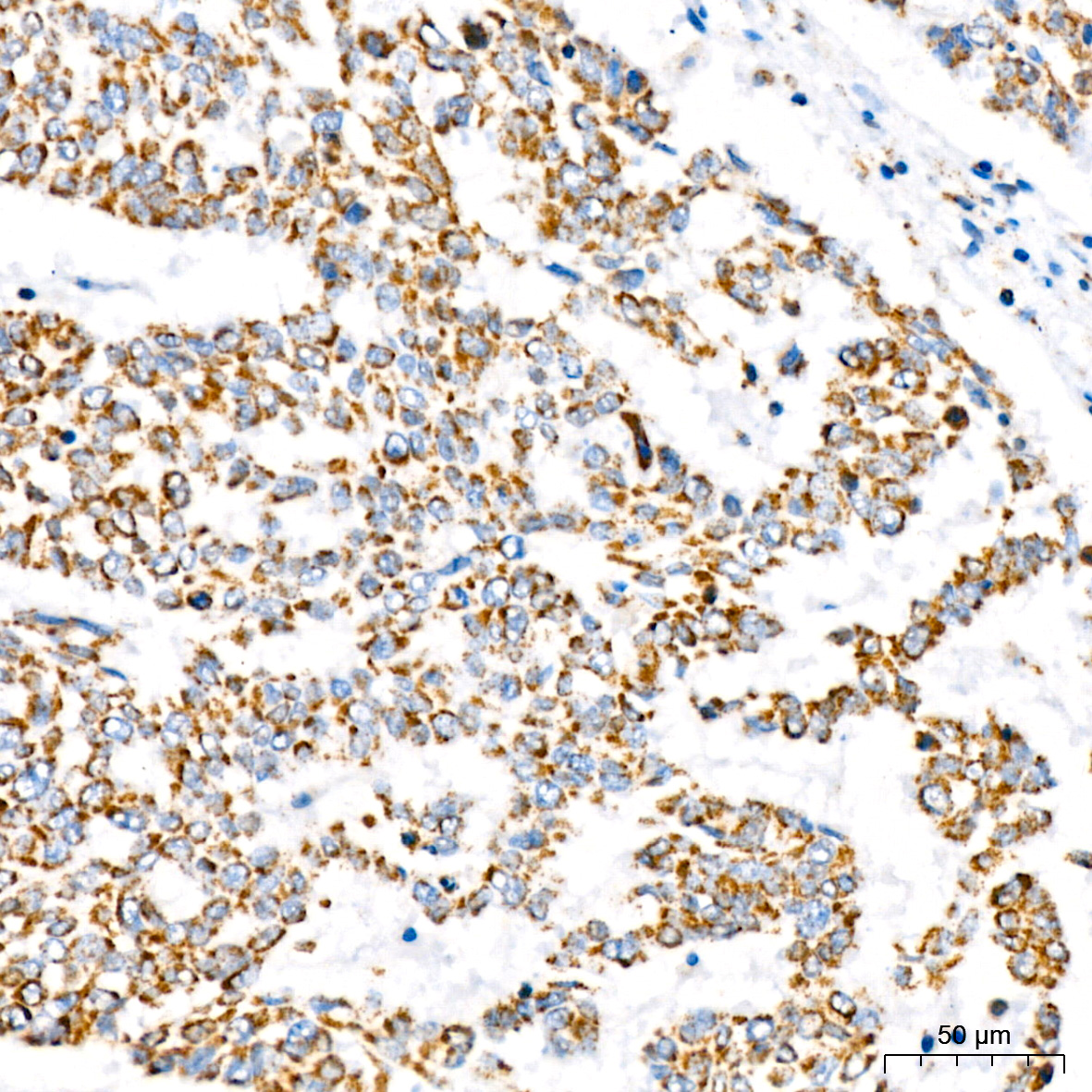 ATP5A1 Rabbit mAb