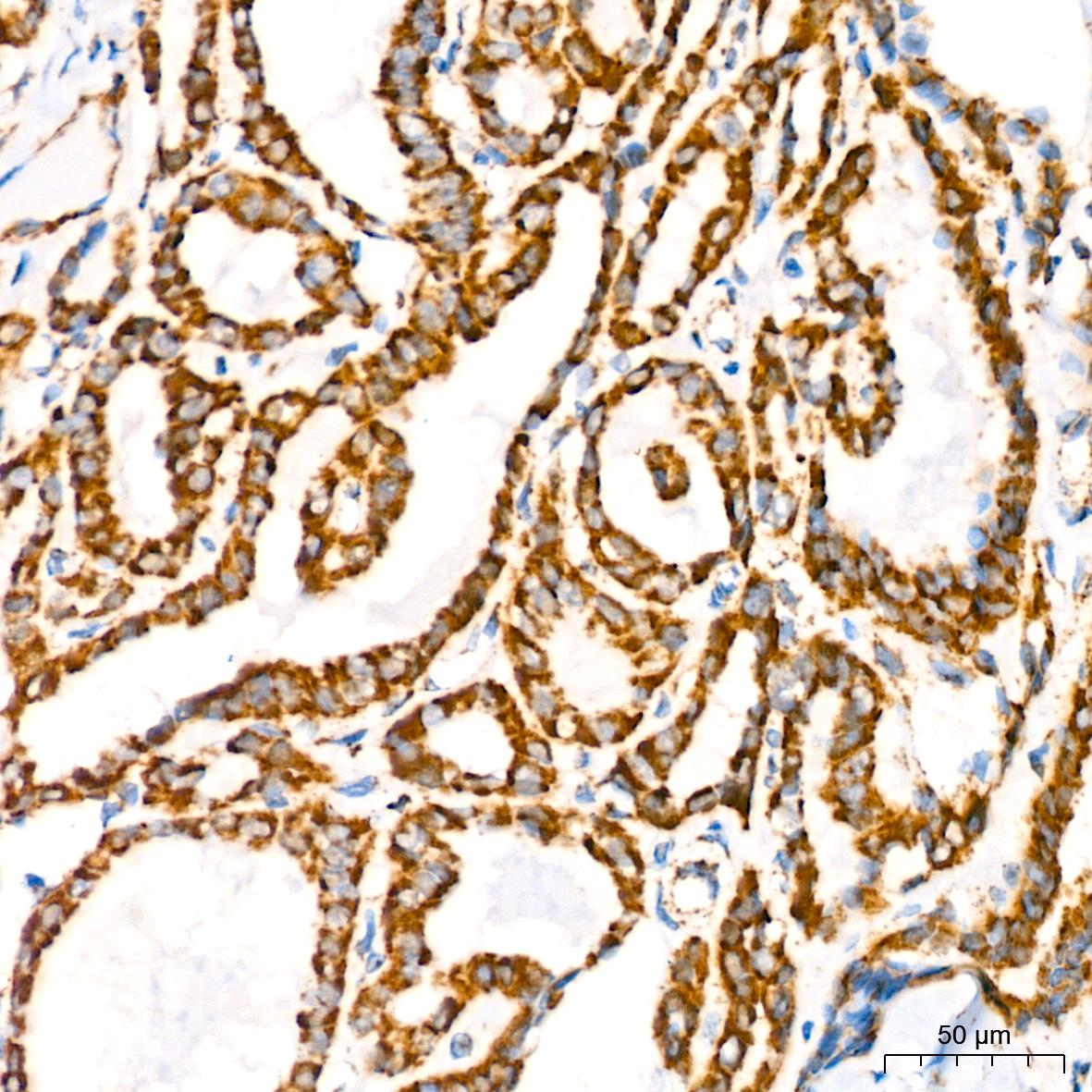 ATP5A1 Rabbit mAb