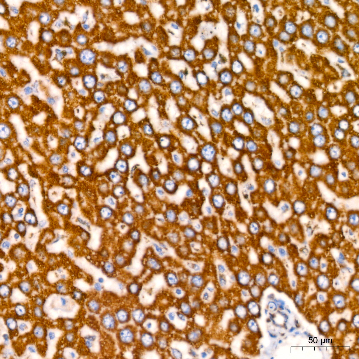 ATP5A1 Rabbit mAb