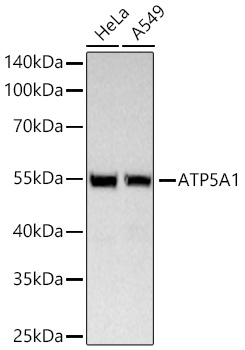 ATP5A1 Rabbit mAb