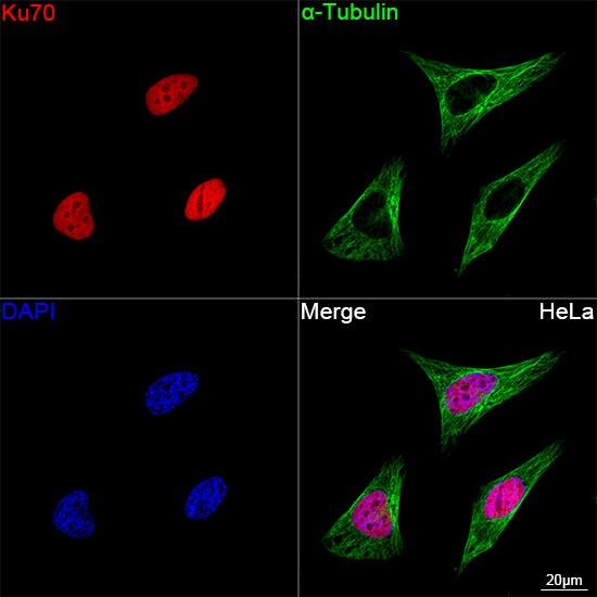 Ku70 Rabbit mAb