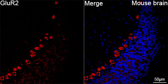 GluR2/GRIA2 Rabbit mAb