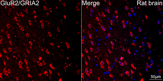 GluR2/GRIA2 Rabbit mAb